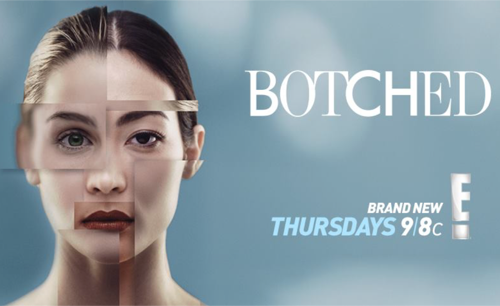 Botched Recap 8/3/17: Season 4 Episode 8 "Sticky Nipples and Paparazzi Nightmares"