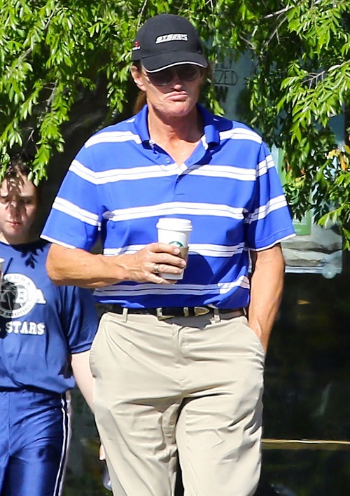 Bruce Jenner Sex Change Operation Update: Recovering From Breast Implant Surgery - Full Gender Reassignment Surgery Next