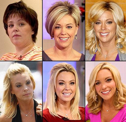 Kate Gosselin Whining About No Steady Income - Cuts Back On Plastic Surgery (Photo)