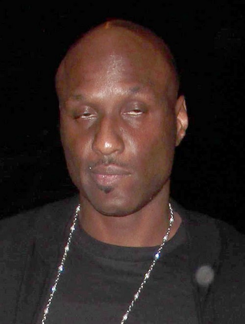 Lamar Odom Brain Damaged After Overdose: Doesn’t Recognize Friends or Family