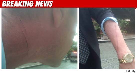 Michael Lohan breaks media silence - neck slashed